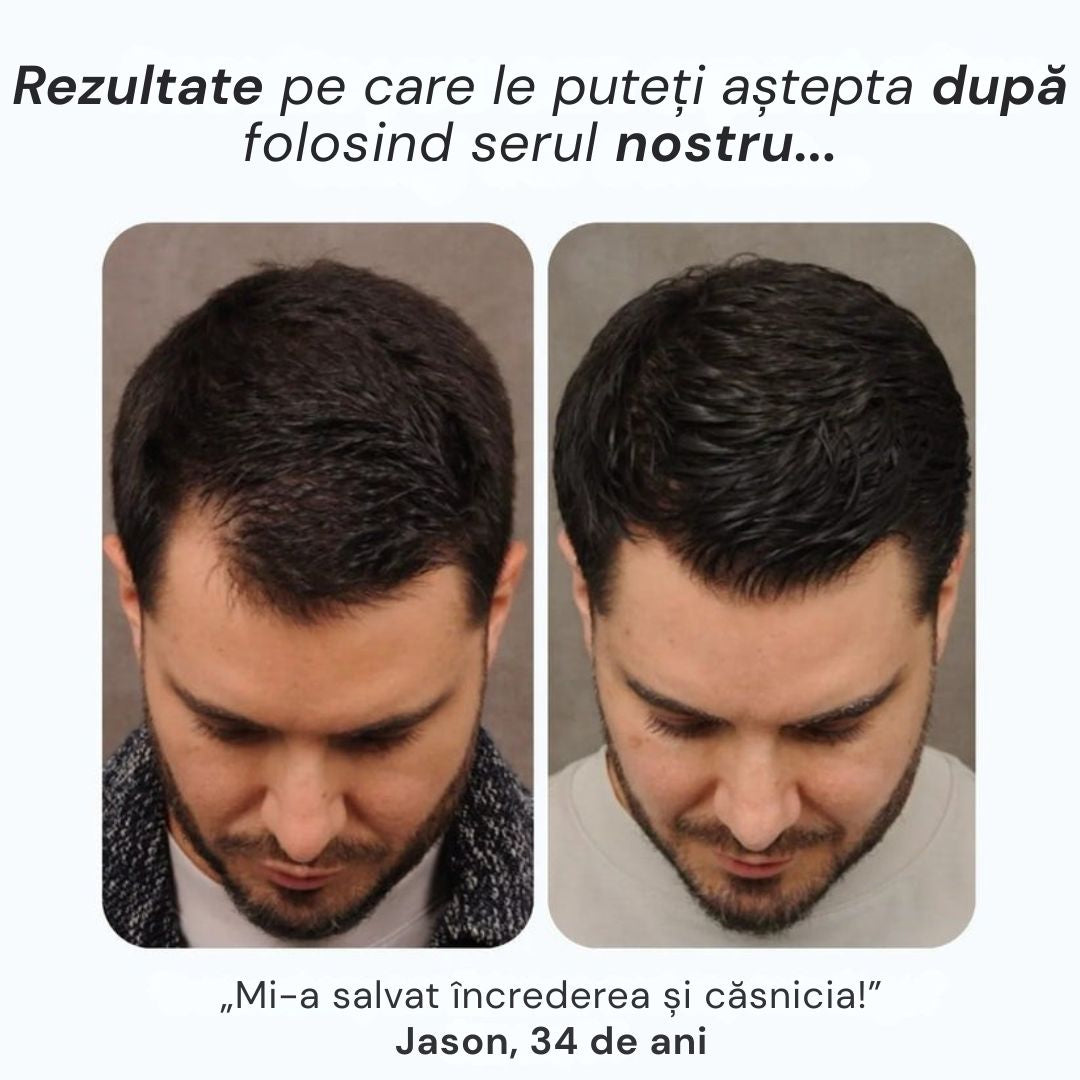 Daynava™ Roll-On pentru Creșterea Părului
