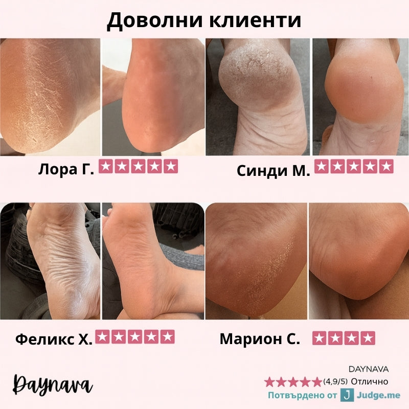 Електрическа пила за стъпала Daynava