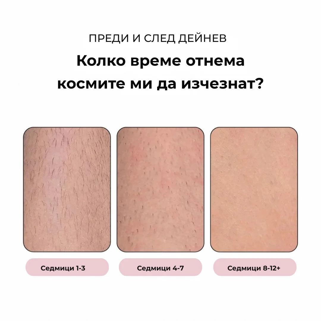 Daynava™ IPL Епилатор (BU)