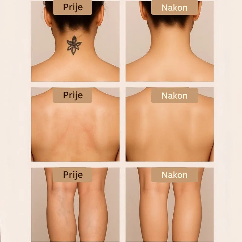 Daynava Set Četkica za Body Perfecter