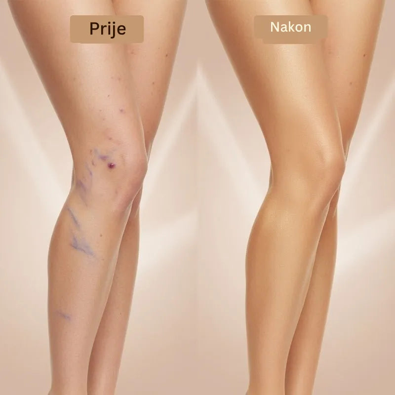 Daynava Set Četkica za Body Perfecter