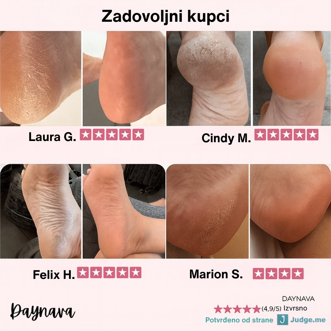 Električna rašpica za stopala Daynava