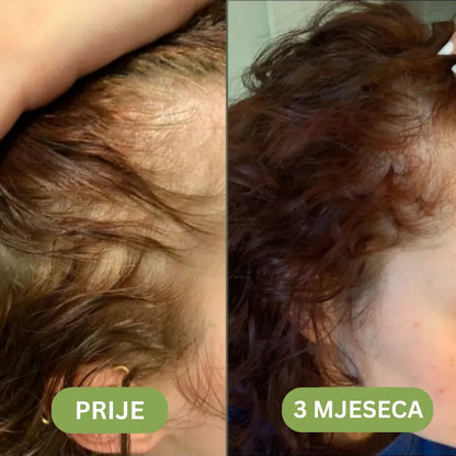 Daynava™ Hair Growth Oil