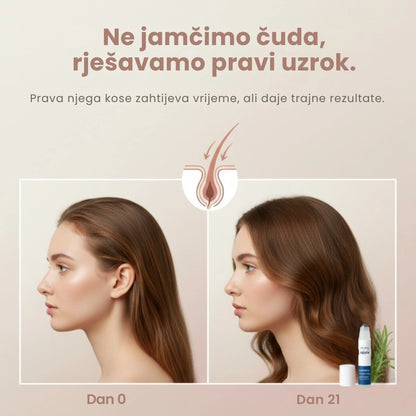 Daynava™ Roll-On za rast kose