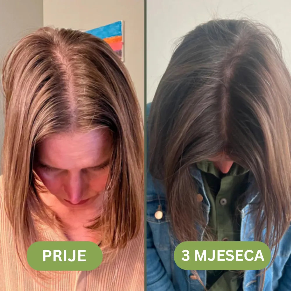 Daynava™ Hair Growth Oil