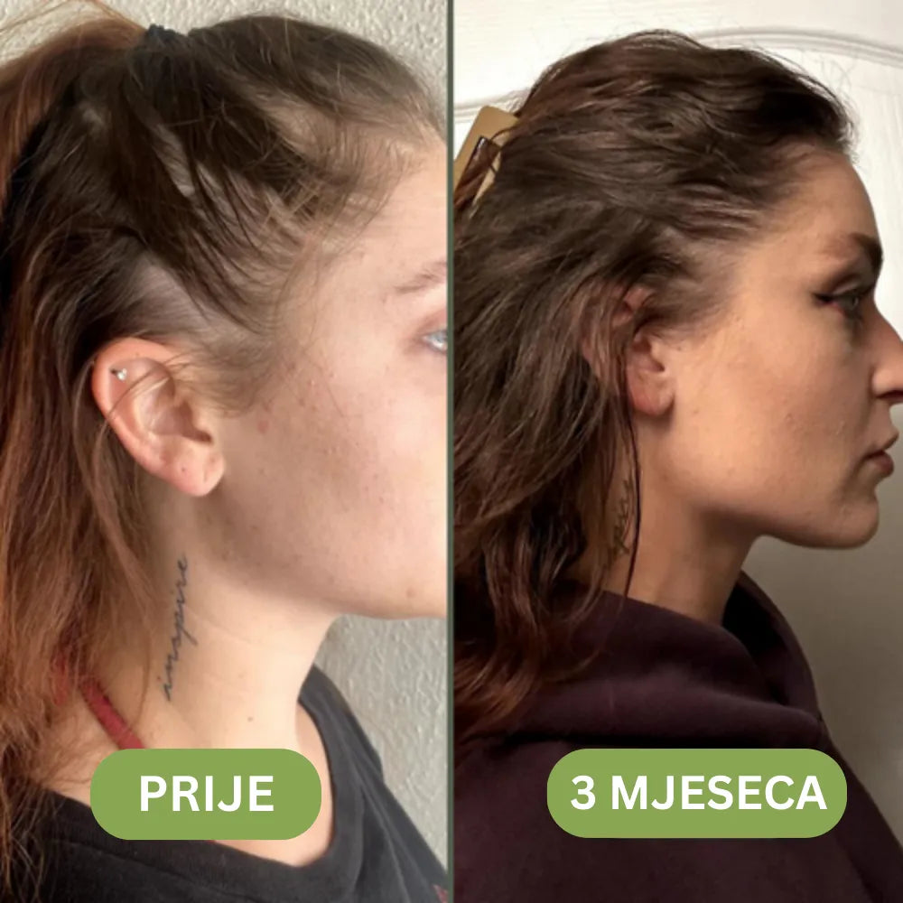 Daynava™ Hair Growth Oil