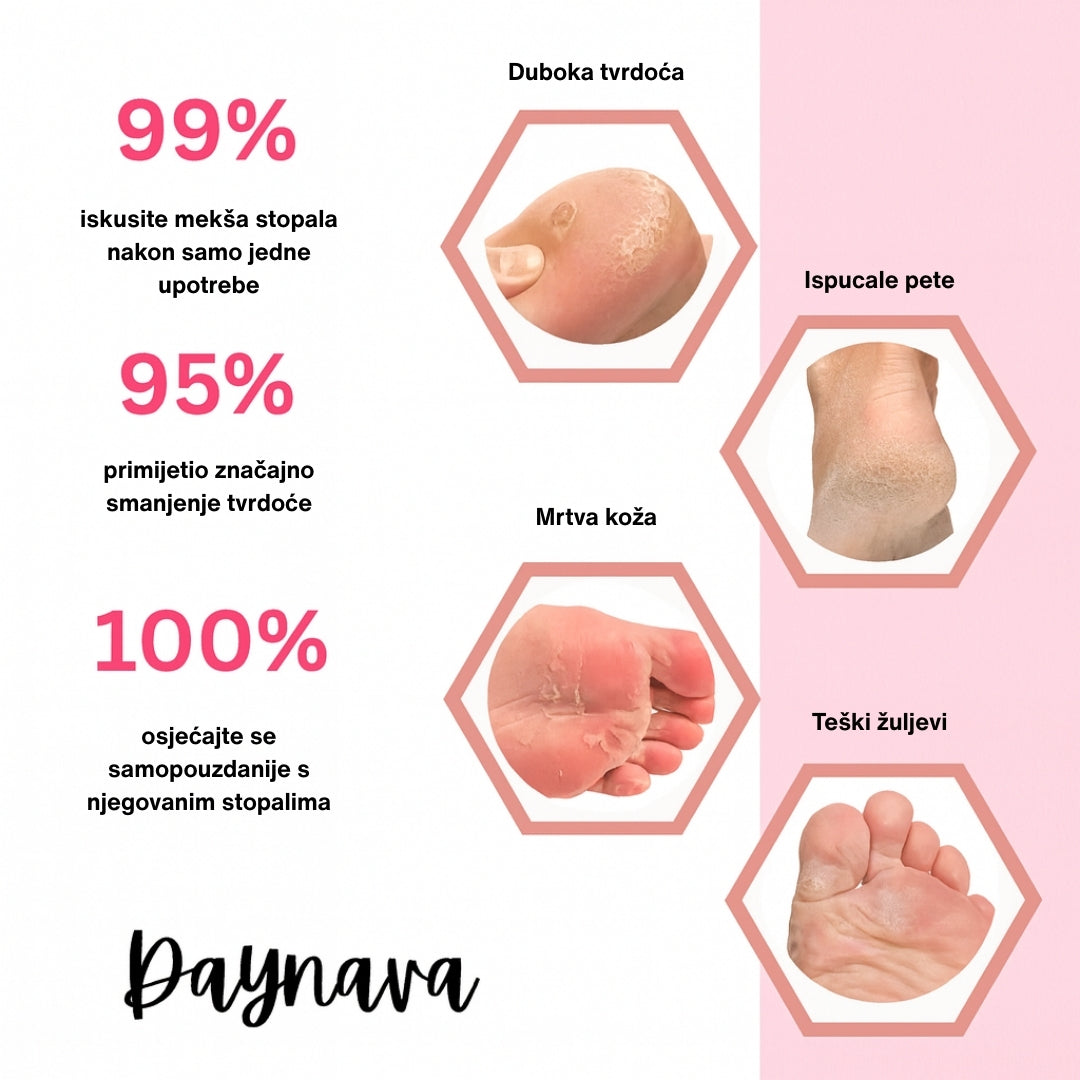 Električna rašpica za stopala Daynava