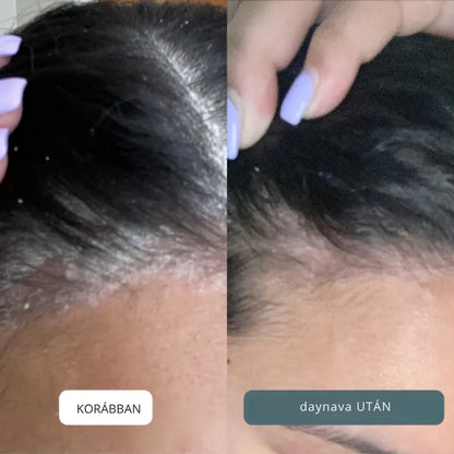 Nyugtató krém fejbőrre és bőrre
