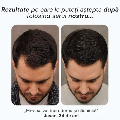 Daynava™ Roll-On pentru Creșterea Părului