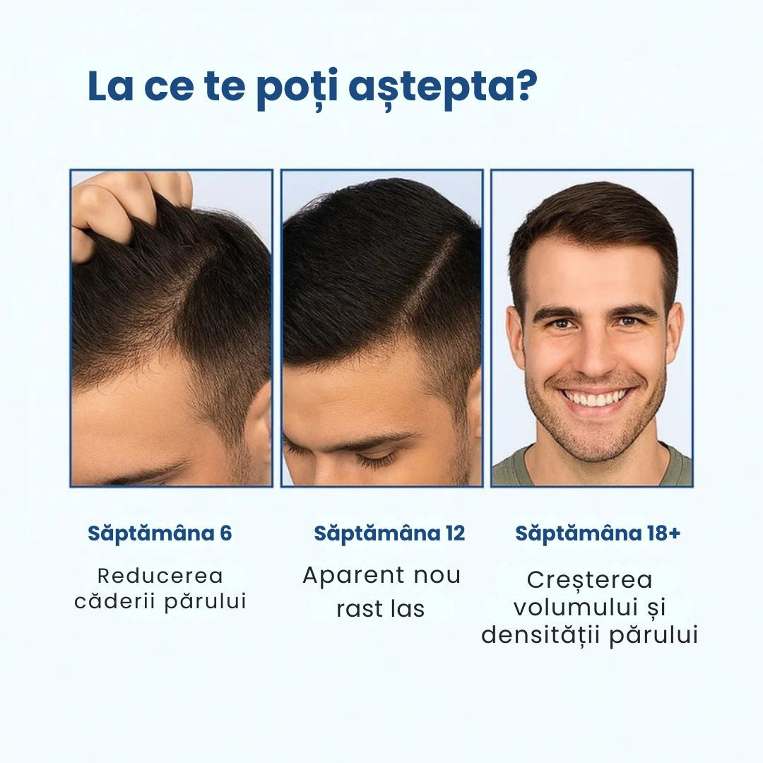 Daynava™ Roll-On pentru Creșterea Părului