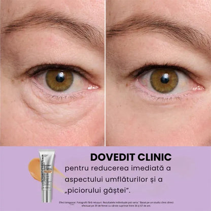 Daynava™ Ridică Instant Zona Ochilor